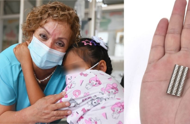 niña de nueve años fue intervenida tras tragarse 20 piezas